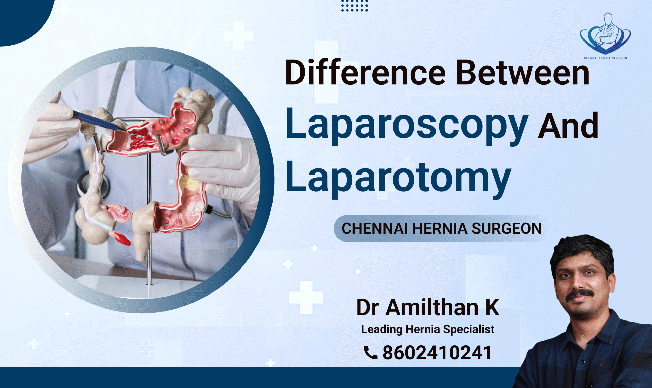 Difference between Laparoscopy and Laparotomy